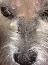 Dermatomyositis