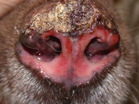 Discoid Lupus