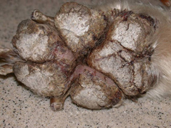 Hepatocutaneous Syndrome