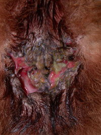 Perianal Fistulas