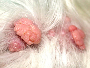 Sebaceous Adenoma