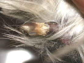 Symmetric Lupoid Onychodystrophy