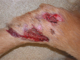 Valley Fever